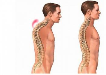 Миостимуляция мышц тела: показания, противопоказания и особенности процедуры Многие годы безуспешно боретесь с болями в суставах
